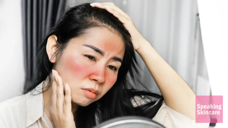 A woman with skin irritation