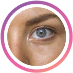Skin type story image