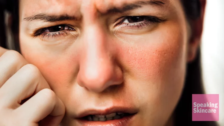 A woman with red cheeks