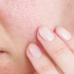 A woman touching her face