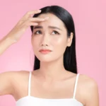 A woman with oily skin