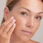 how to get rid of dark spots on face