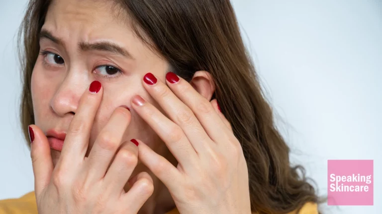 itchy eyelids