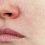 A woman with a dry mouth