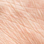 how to improve skin texture