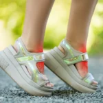 what to put on chafed skin chafing relief