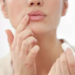 how to get rid of dark skin above upper lip