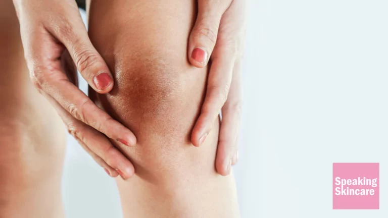 how to make your knees lighter