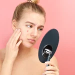 how to get rid of under the skin pimples or blind pimples