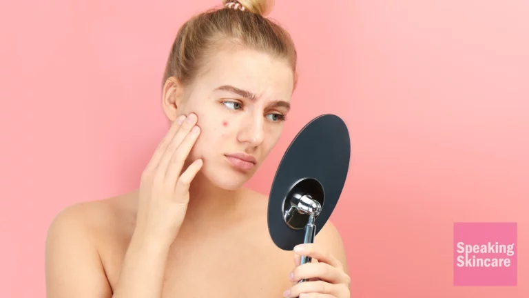 how to get rid of under the skin pimples or blind pimples
