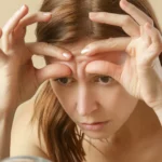 fine lines around mouth eyes and on face