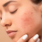 what is skin inflammation