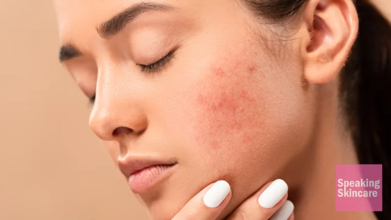 what is skin inflammation