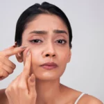how to get rid of red spots on face