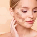 how to get rid of uneven skin tone