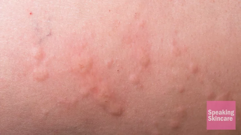 bumps on face